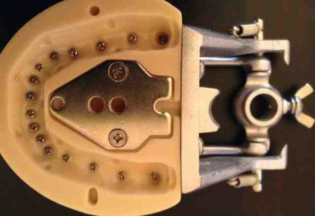 Модель челюсти на окклюдаторе со съёмными зубами